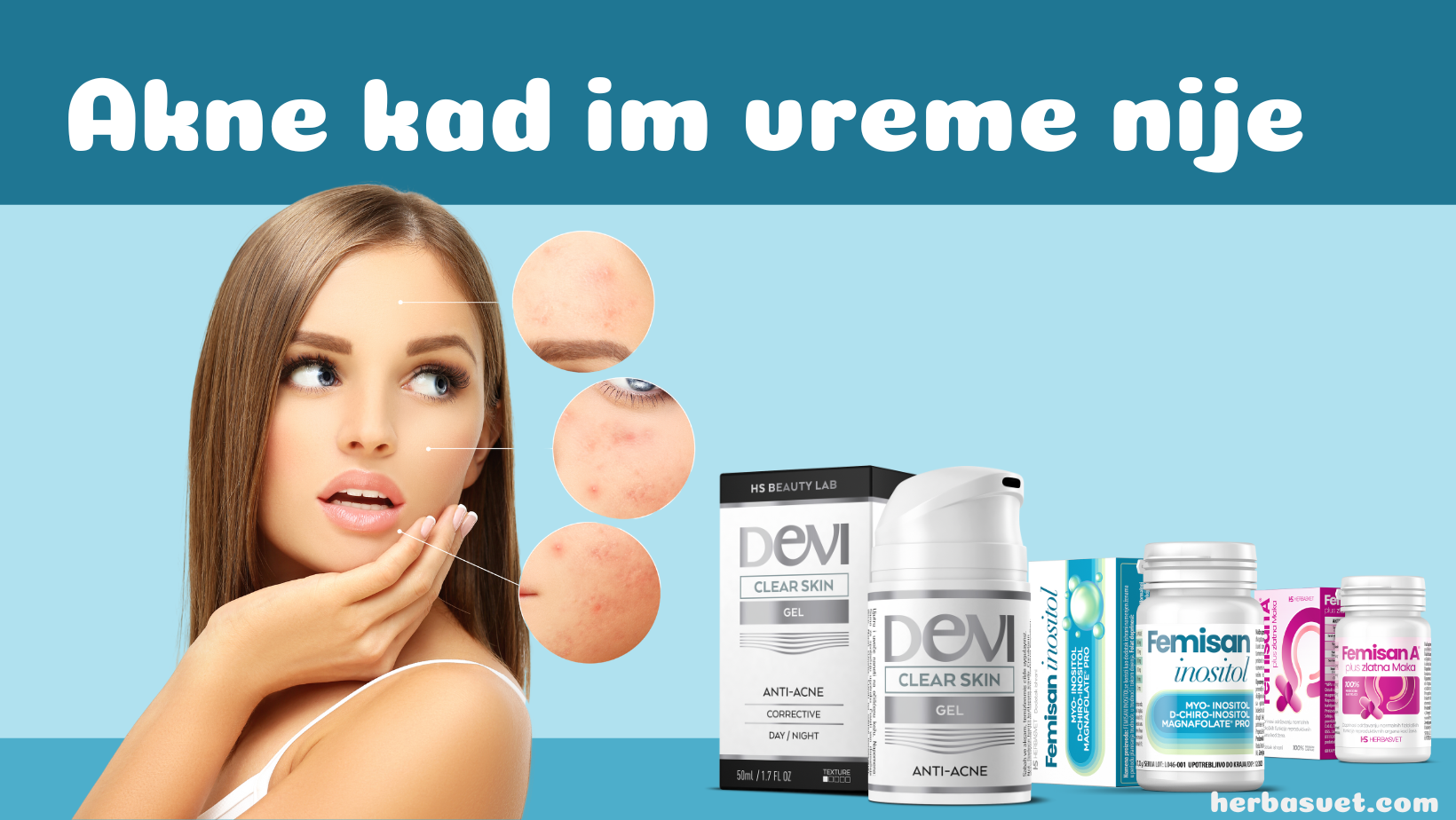 Hormonske akne: akne kad im vreme nije