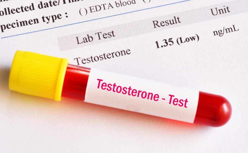 testosteron test