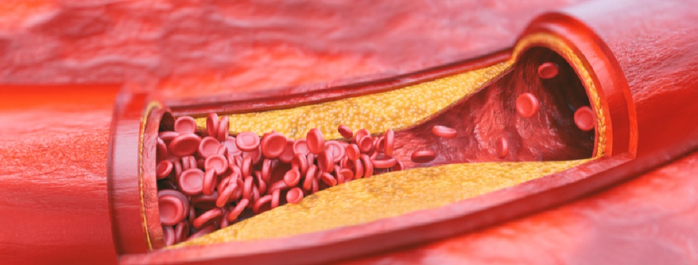 krvni sudovi u menopauzi