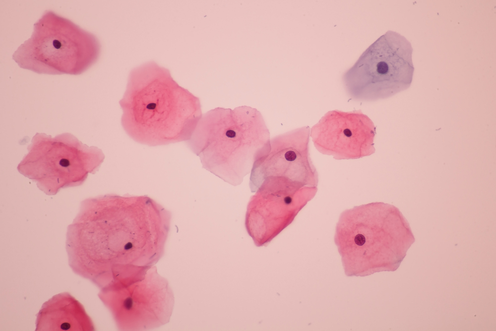 HPV pod mikroskopom