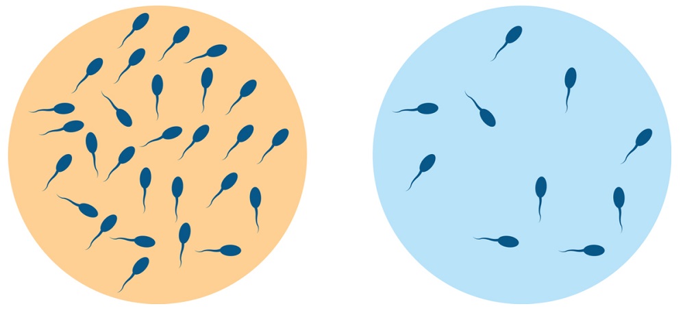 virus utiče na broj i pokretljivost spermatozoida
