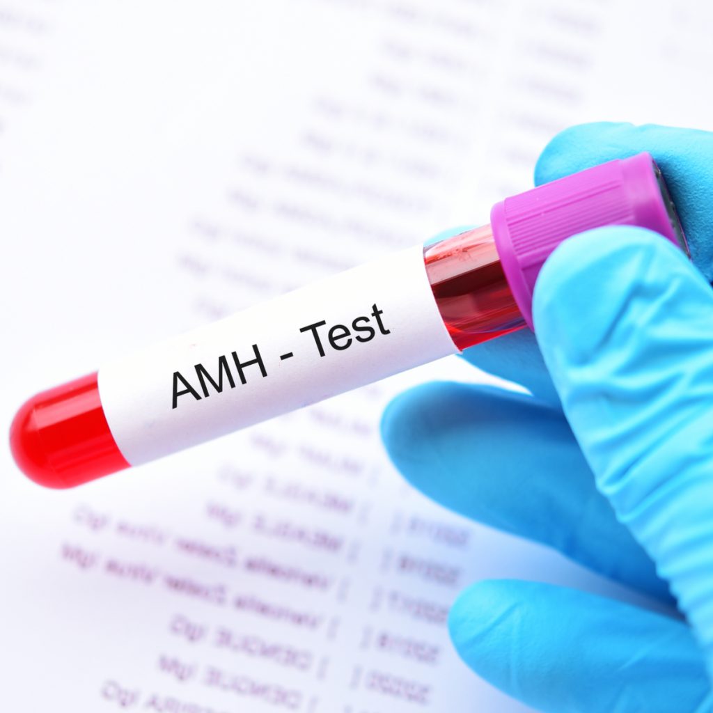 AMH Test