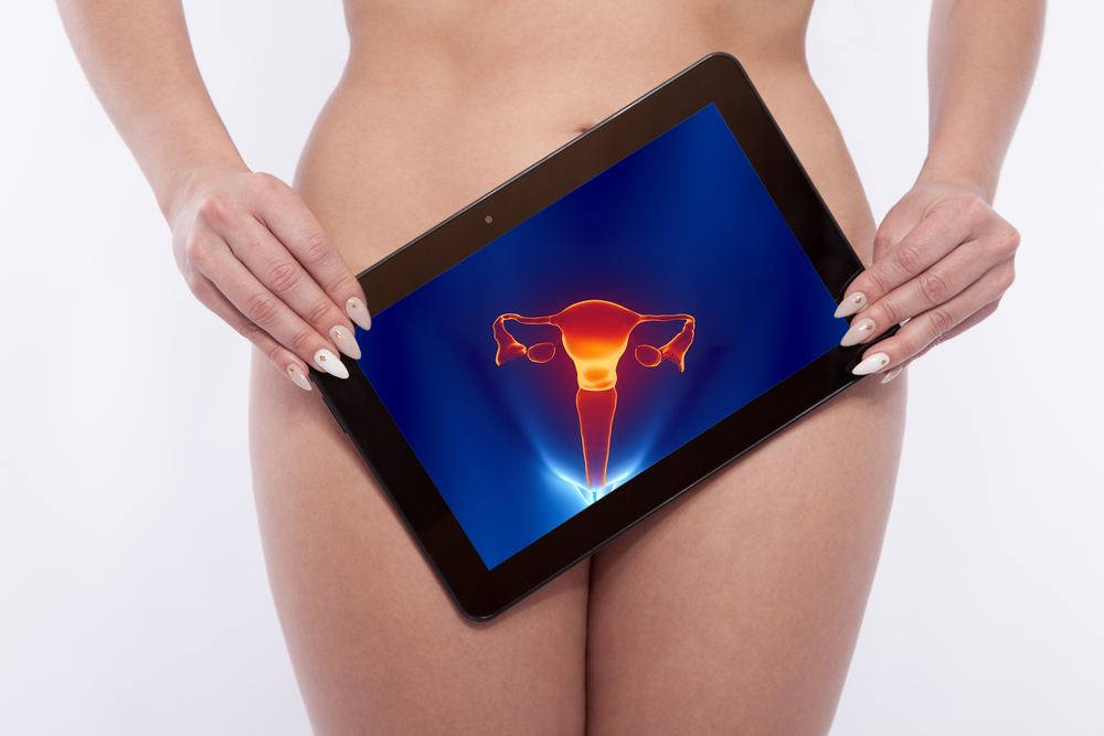 uterine fibroids, illustration