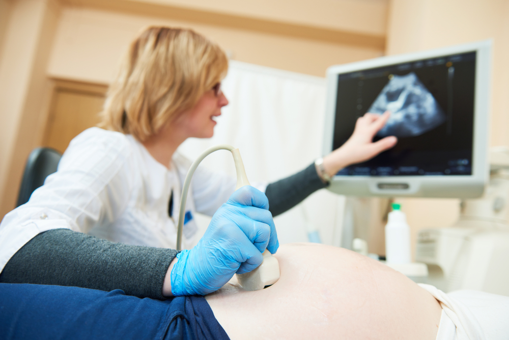 A pregnant woman at an ultrasound checkup