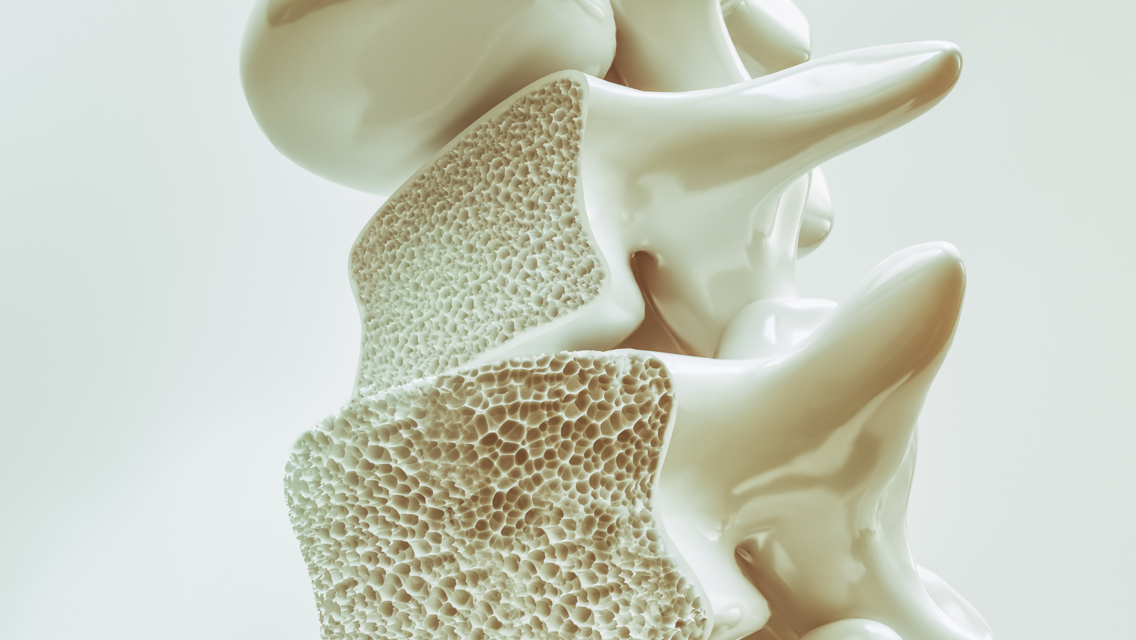 osteoporoza kostiju kičme