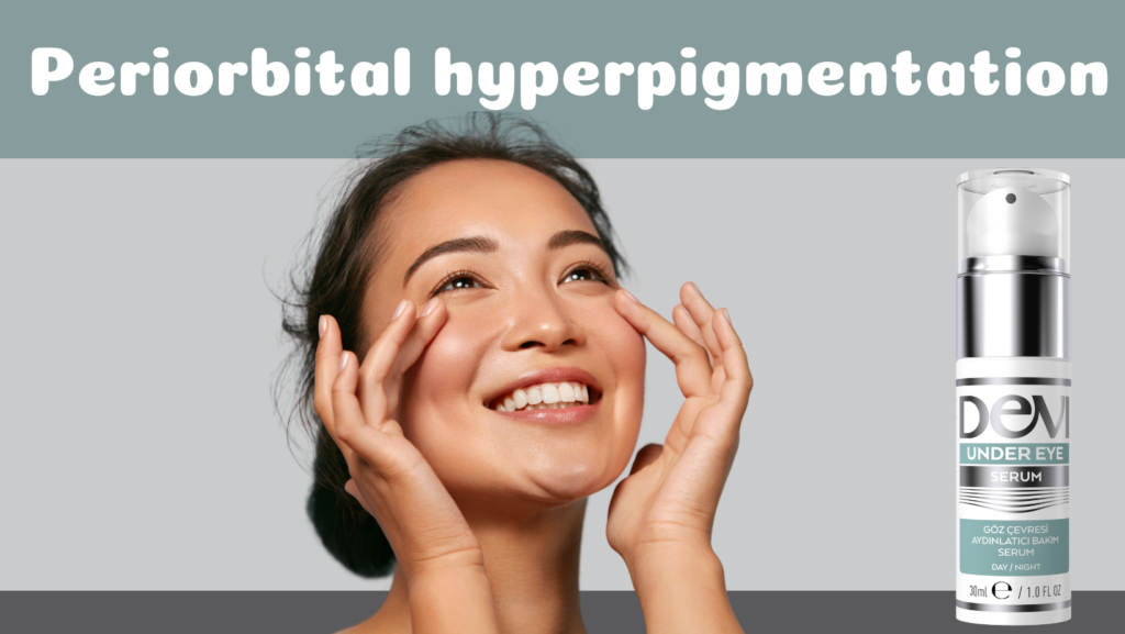 Puffy or dark circles around the eyes, also known as periorbital hyperpigmentation