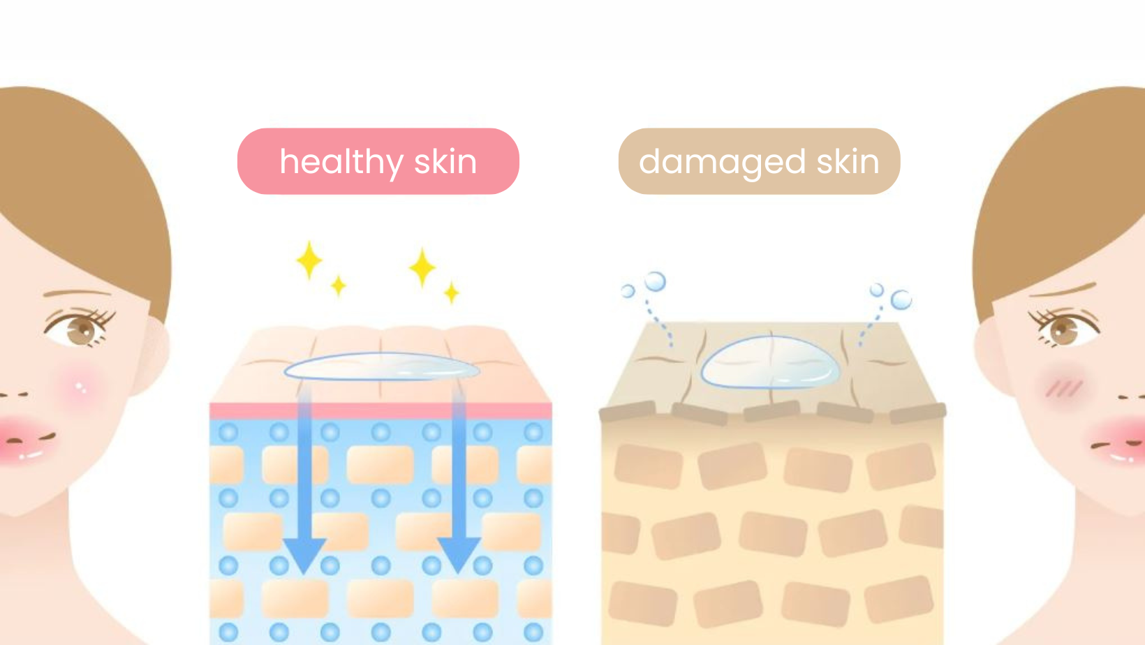 An illustration of healthy and damaged skin.