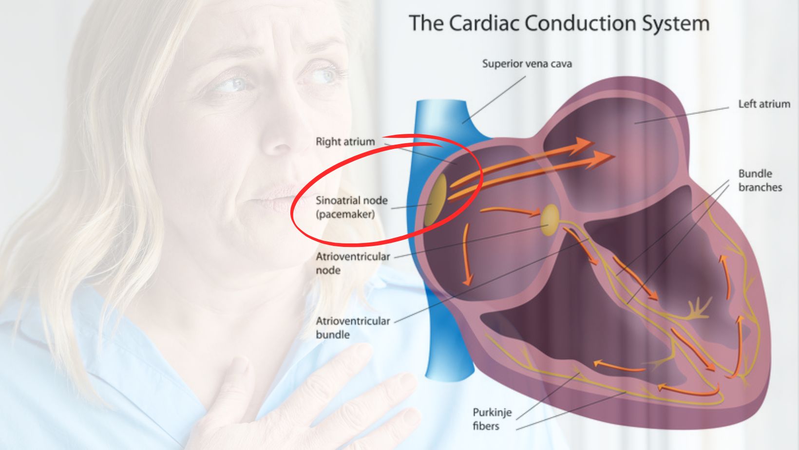 Anatomija srca, sinoatrijalni čvor i žena koja oseća palpitacije