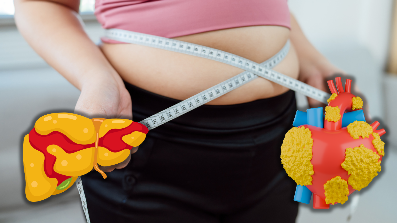Gojazna žena, visceralne masti
