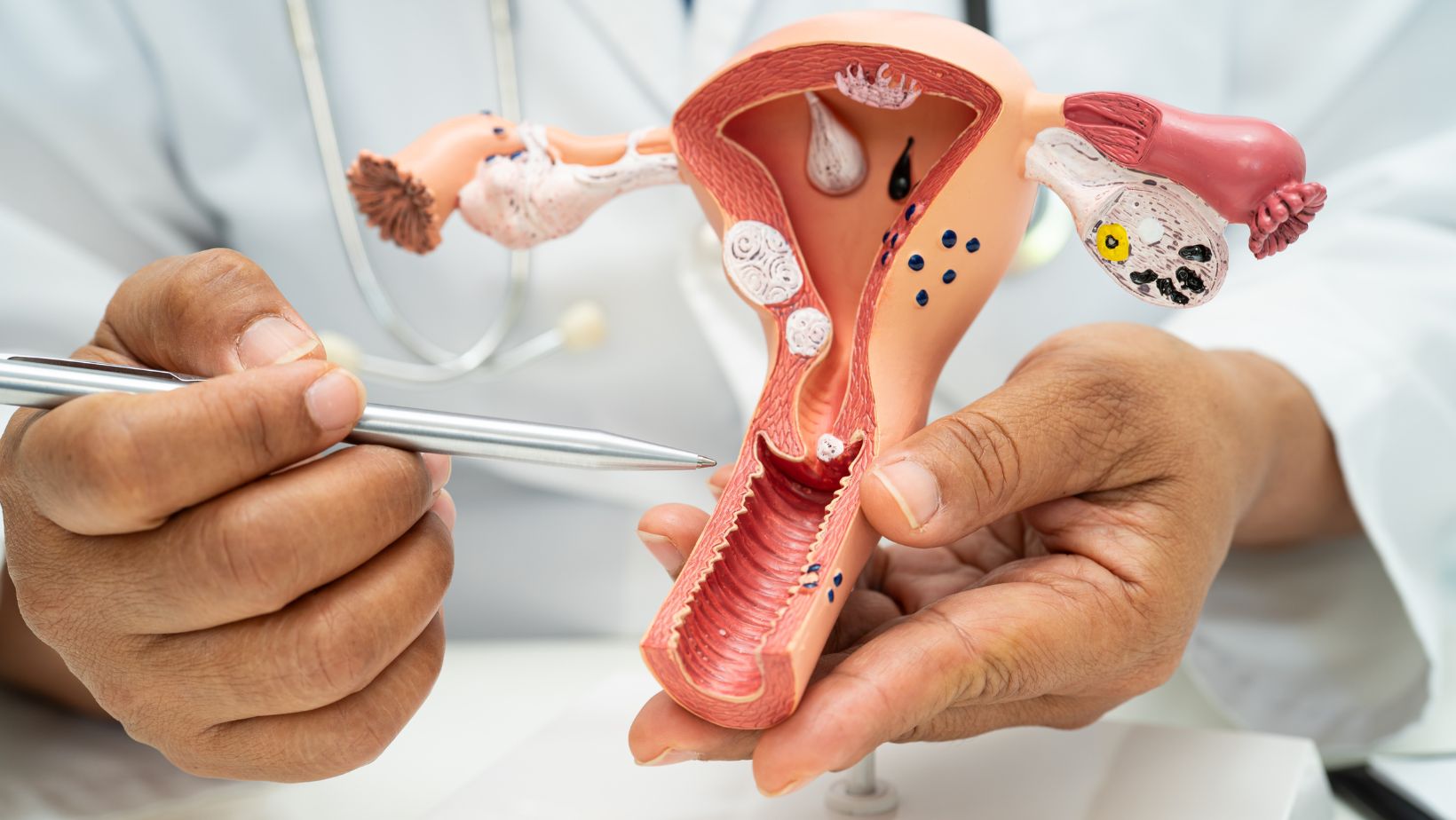 Doktor pokazuje grlić na modelu materice