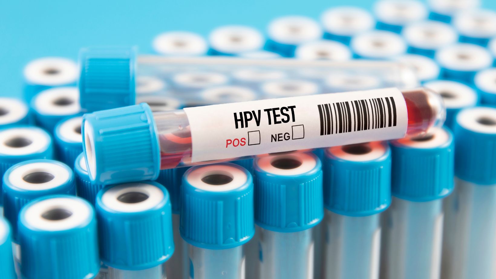 HPV test, epruvete